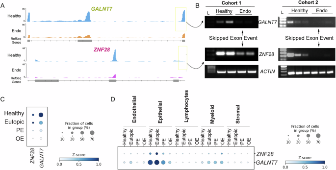 Fig. 4: Validation of altered mRNA splicing events in ZNF28 and GALNT7 genes.