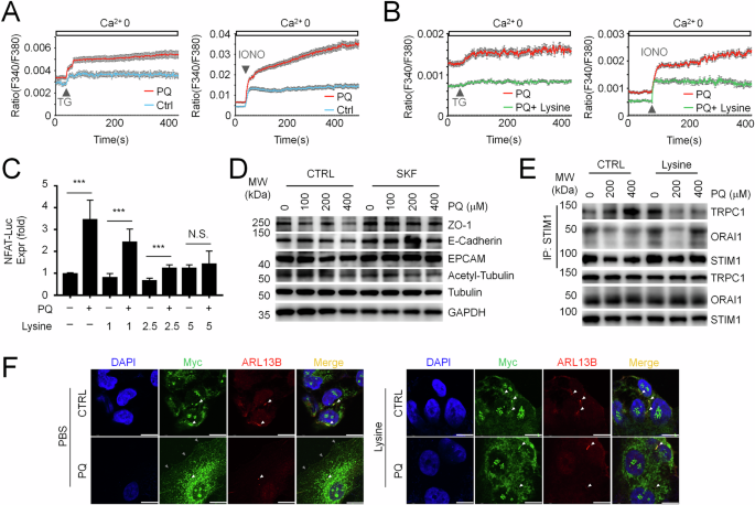 Fig. 5: Lysine suppresses PQ-induced pathological STIM1-TRPC1 association and excessive intracellular calcium burden.