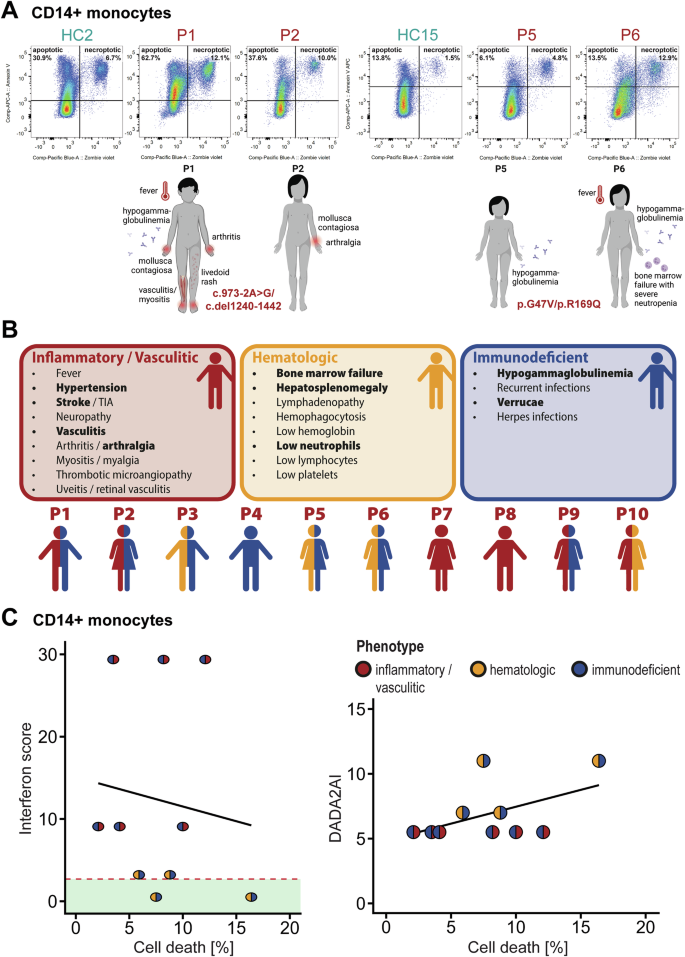 Fig. 1: Phenotype and cell death levels in DADA2 patients.