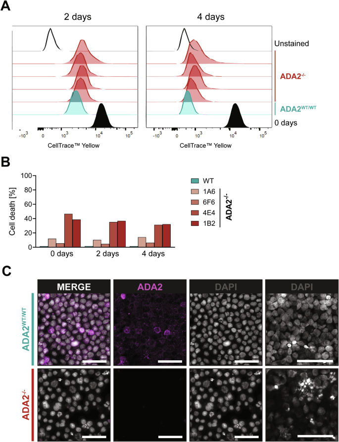 Fig. 6: Proliferation and morphology of ADA2-deficient cells.