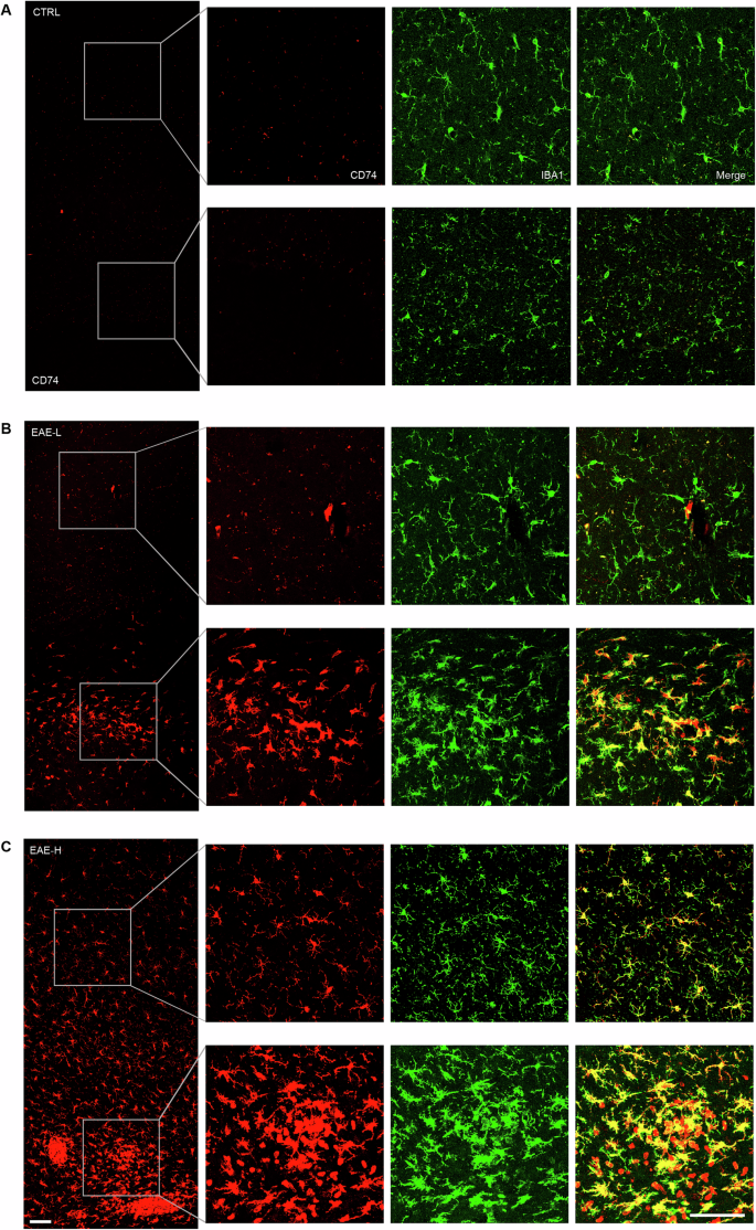 Fig. 5: EAE-H mice exhibit a wider expression of microglial CD74 compared to the EAE-L subgroup.