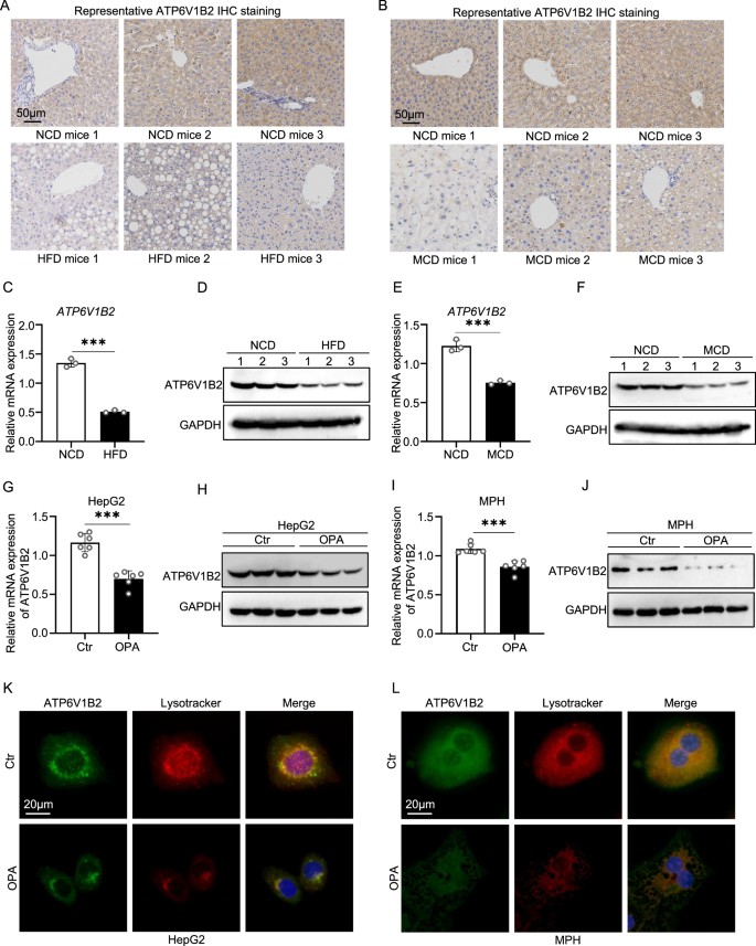 Fig. 2: ATP6V1B2 expression is decreased in MASLD mice and lipotoxic hepatocytes.