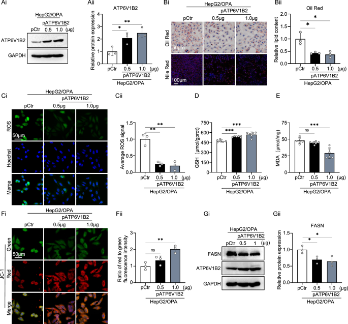 Fig. 4: ATP6V1B2 inhibits OPA-induced lipid deposition and oxidative stress in HepG2 cells.
