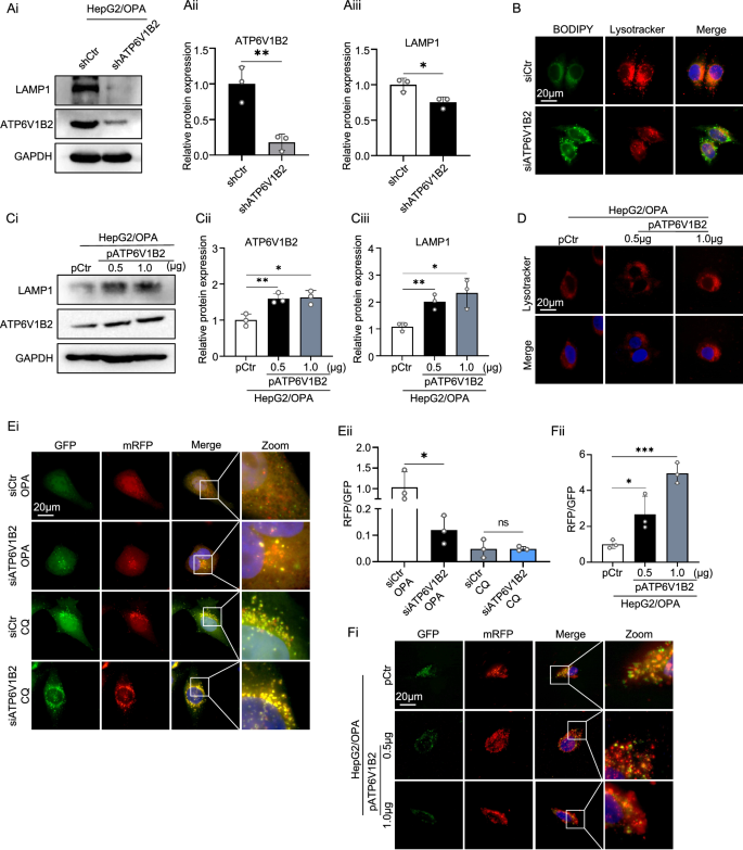 Fig. 5: ATP6V1B2 acidifies lysosomes to promote cellular autophagy.