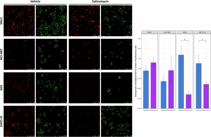 Fig. 3: Salinomycin treatment led to mitochondrial membrane depolarization.
