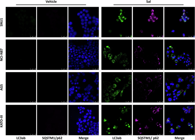 Fig. 4: Autophagy was an early RCD common to all GC cell lines.