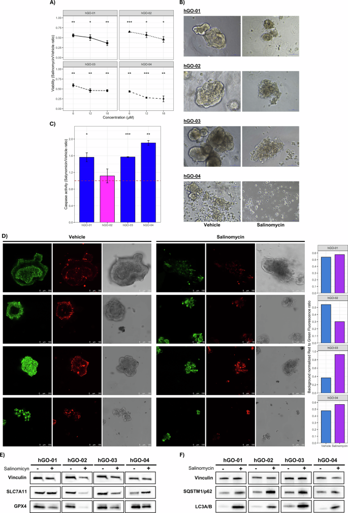Fig. 9: Effectiveness of Salinomycin on human Gastric Organoids (hGOs).