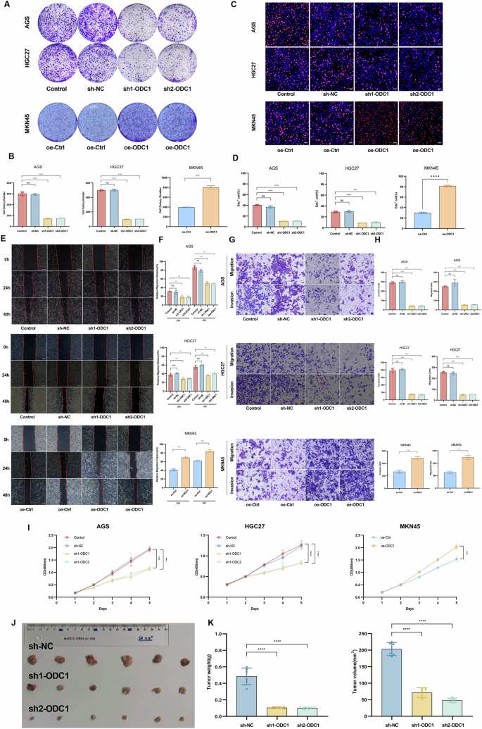Targeting the ODC1-YBX1 axis reverses gastric cancer chemoresistance via transcriptional control of SLC7A11-mediated ferroptosis
