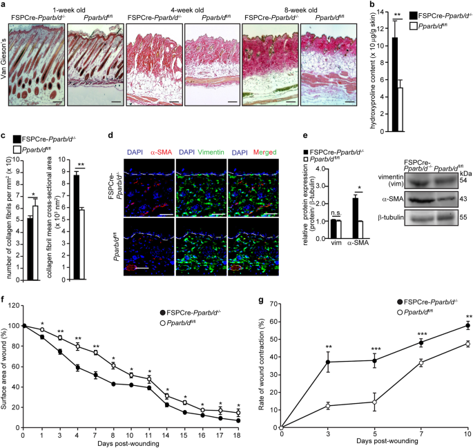 Fig. 2: Increased collagen deposition in dermis of FSPCre-Pparb/d−/− mice.