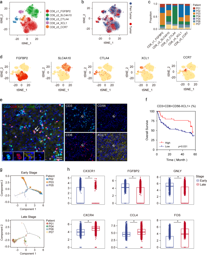 Fig. 5: Infiltration of diverse CD8+ T-cell subsets in HCC.