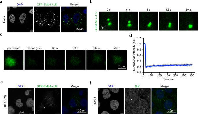 Fig. 1: Phase separation of EML4–ALK variant 1 in human cancer cell lines.