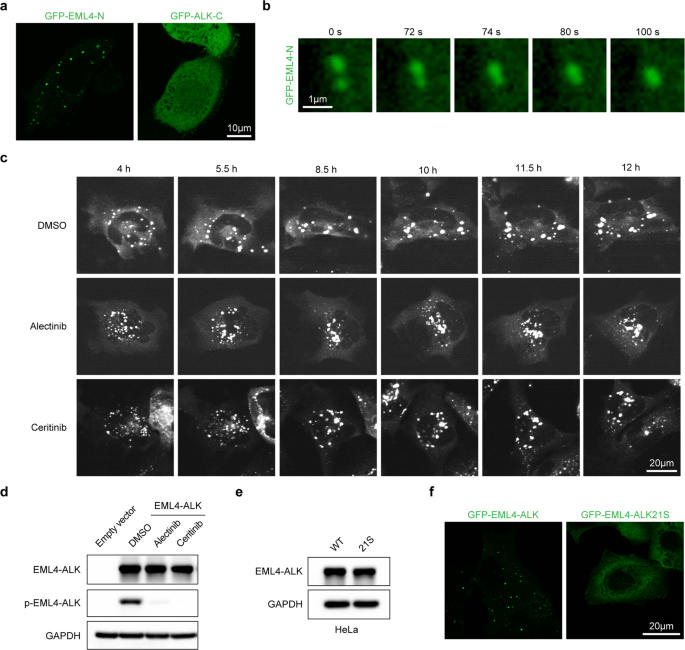 Fig. 4: The EML4–ALK21S mutant fails to phase separate.