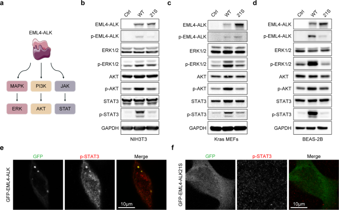 Fig. 5: The 21S mutations markedly attenuate the EML4–ALK-induced hyperactivation of downstream signaling pathways.