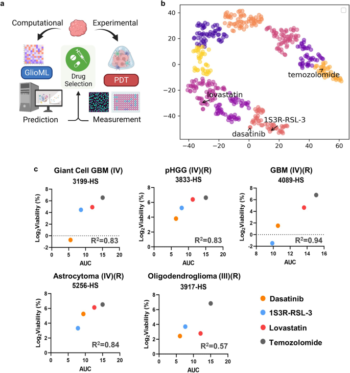 Fig. 4: Integration of bioprinted PDTs and GlioML for precision medicine.