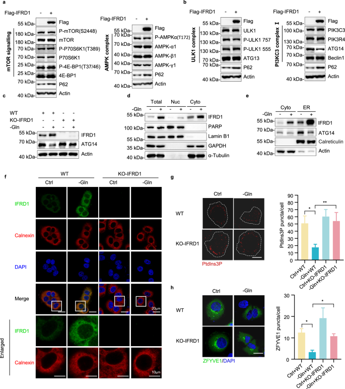 Fig. 3: IFRD1 inhibits autophagy through downregulation of ATG14.