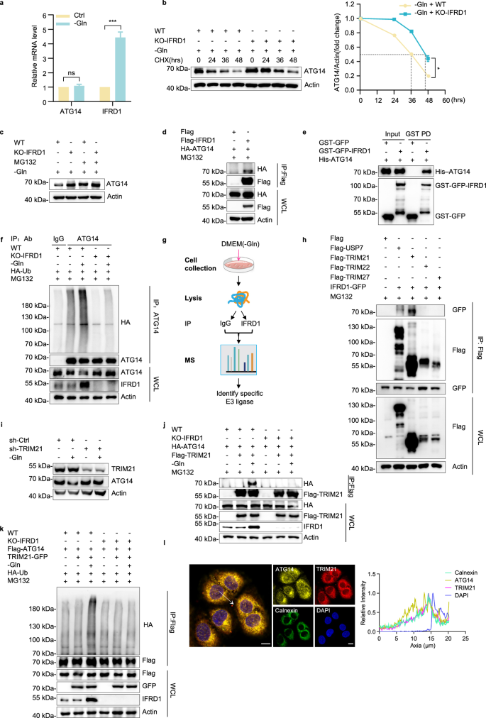 Fig. 4: IFRD1 facilitates ATG14 protein degradation via TRIM21-mediated ubiquitination in response to glutamine deprivation.