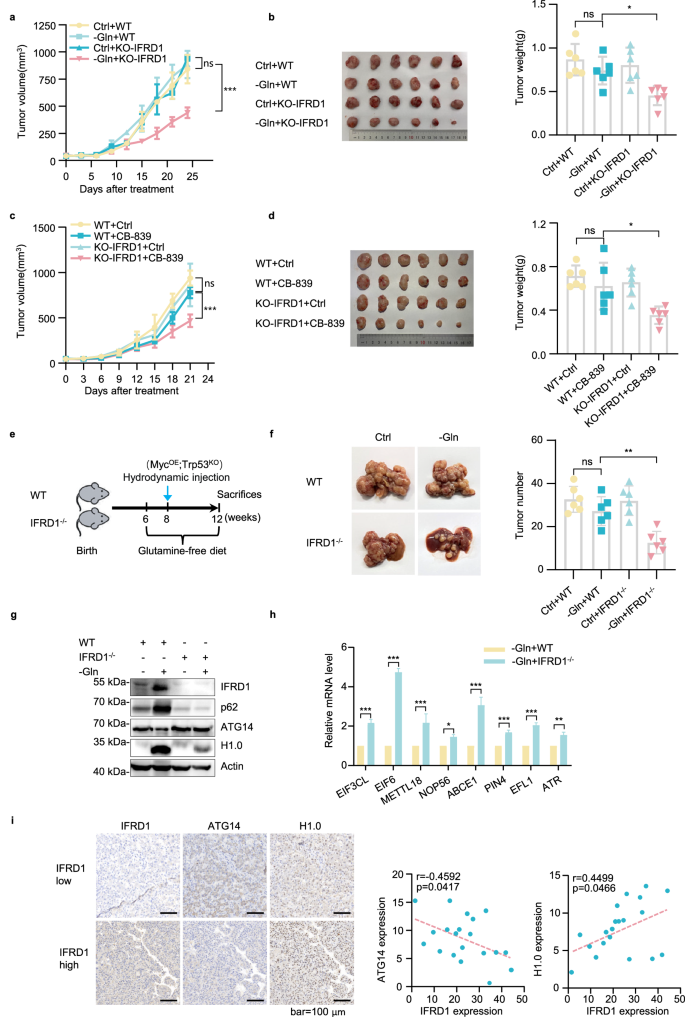 Fig. 7: IFRD1 loss enhances glutamine starvation therapy of HCC in vivo.