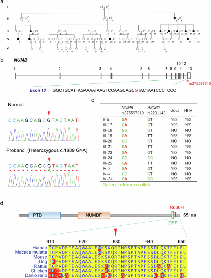 Fig. 1: Genetic alteration of NUMB gene in patients with inherent hyperuricemia and gout.