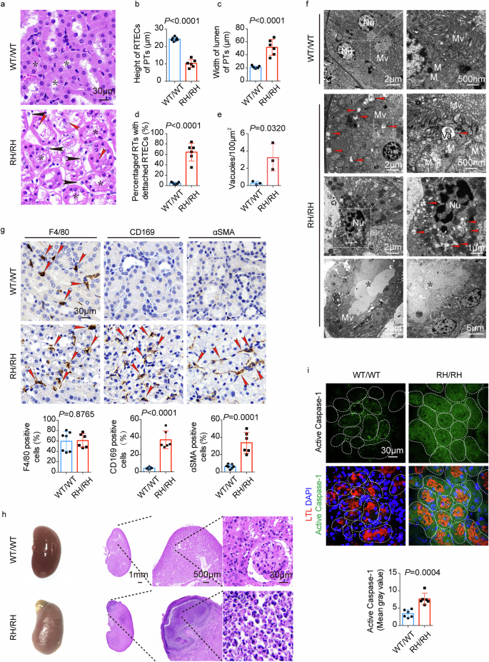 Fig. 6: Chronic uric acid nephropathy in NUMBR632H /NUMBR632H homozygous mice.