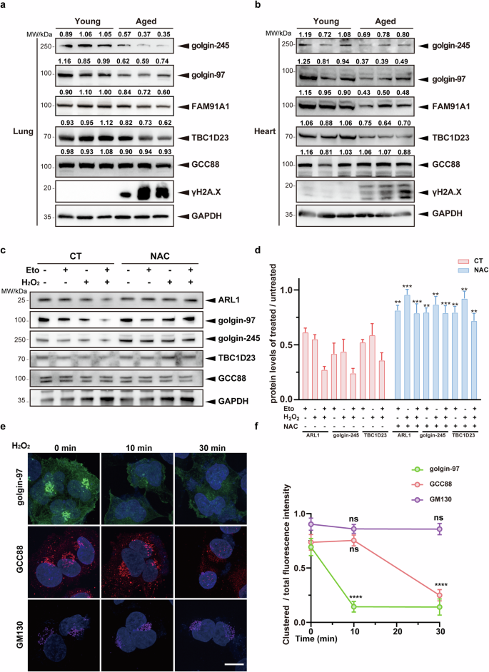 Trans-Golgi network tethering factors regulate TBK1 trafficking and promote the STING-IFN-I pathway