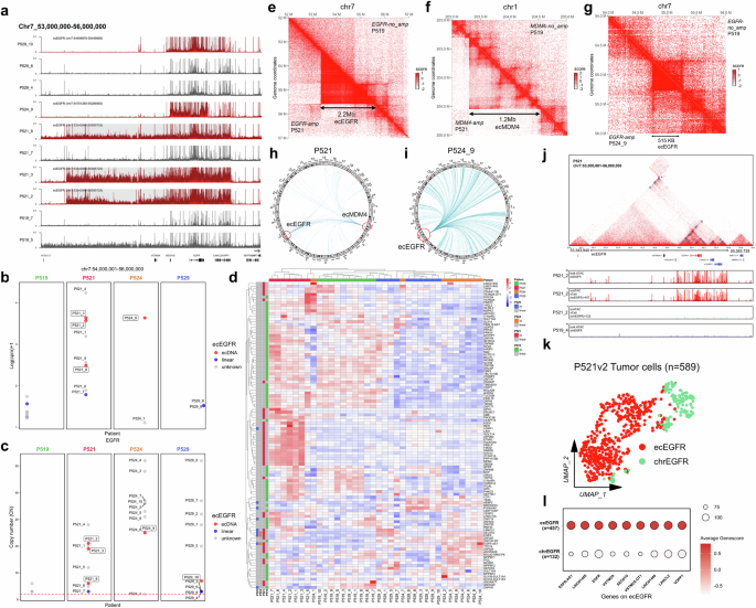 Fig. 6: Spatial heterogeneity of ecDNA from four GBM patients.