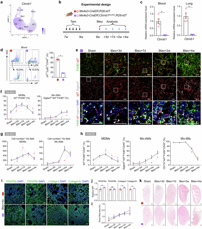Fig. 7: Monocyte-specific Ctnnb1 knockout promotes monocyte differentiation into AMs and contributes to persistent fibrosis after bleomycin treatment.