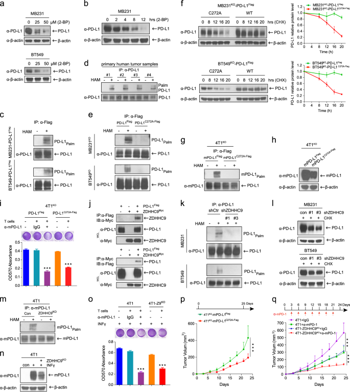 Palmitoylation stabilizes PD-L1 to promote breast tumor growth | Cell  Research