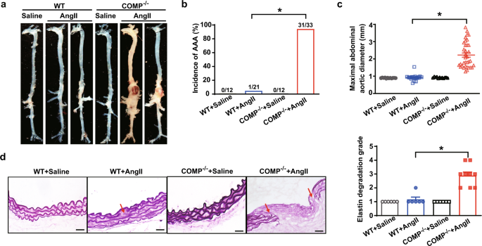 Fig. 2: COMP deficiency aggravates AngII-induced AAA formation.