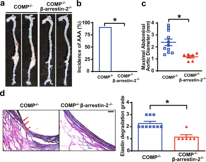 Fig. 6: β-Arrestin-2 mediates the pathological activation of the AT1 receptor aggravated by COMP deficiency.