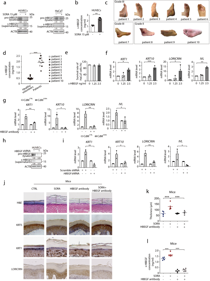 Fig. 2: s-HBEGF governs sorafenib-induced hyper-keratosis.