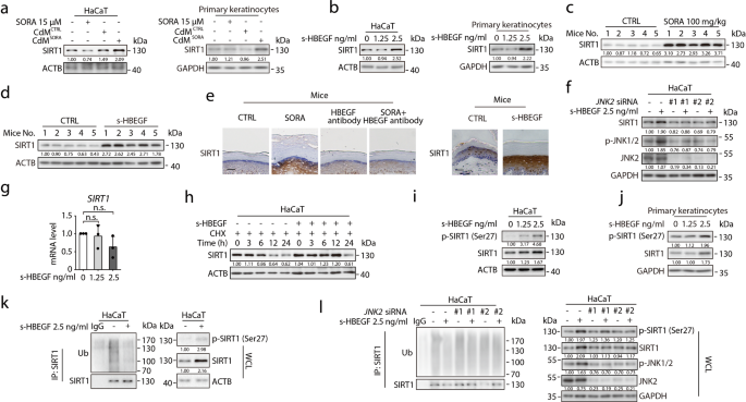Fig. 4: s-HBEGF stabilizes SIRT1 in keratinocytes by increasing its phosphorylation at Ser 27 via JNK2.