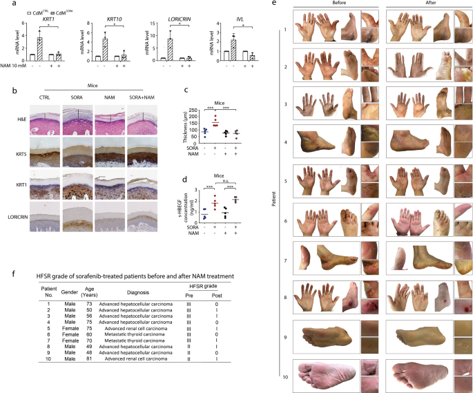 Fig. 6: Classic SIRT1 inhibitor nicotinamide could relieve sorafenib-induced HFSR.