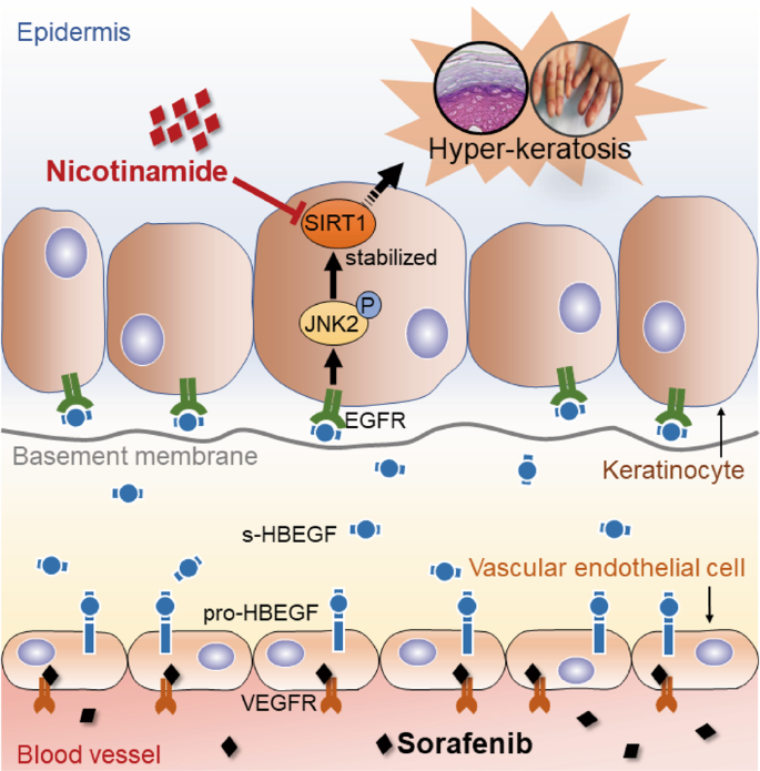 Fig. 7: Schematic representation of the mechanism underlying sorafenib-induced hyper-keratosis.
