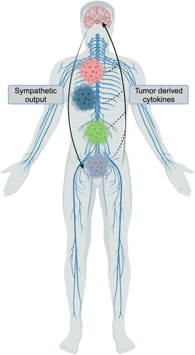 Fig. 1: Redefined model of interactions of peripheral cancers with the CNS.