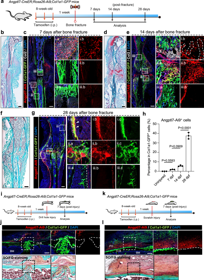 Fig. 3: Angptl7-lineage P-SSCs largely contribute to bone fracture repair by mediating endochondral ossification.