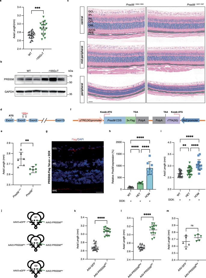Fig. 3: PRSS56 determines ocular axial length in a dosage- and activity-dependent manner.