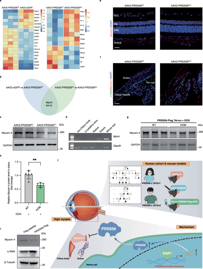 Fig. 5: Overexpression of PRSS56 is associated with reduced myosin-4 abundance.