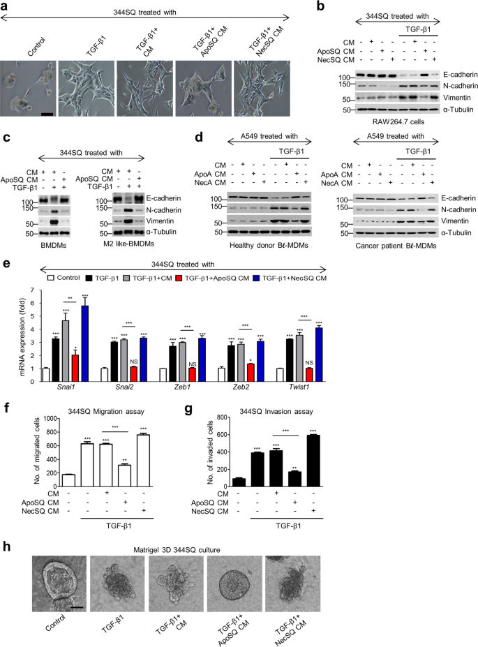 Programming Of Macrophages By Uv Irradiated Apoptotic Cancer Cells Inhibits Cancer Progression And Lung Metastasis Cellular Molecular Immunology