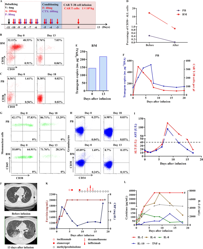 Efficiency And Side Effects Of Anti Cd38 Car T Cells In An Adult Patient With Relapsed B All After Failure Of Bi Specific Cd19 Cd22 Car T Cell Treatment Cellular Molecular Immunology Efficiency And Side Effects Of Anti Cd38 Car T Cells In An Adult Patient With Relapsed B All After Failure Of Bi Specific Cd19 Cd22 Car T Cell Treatment Cellular Molecular Immunology