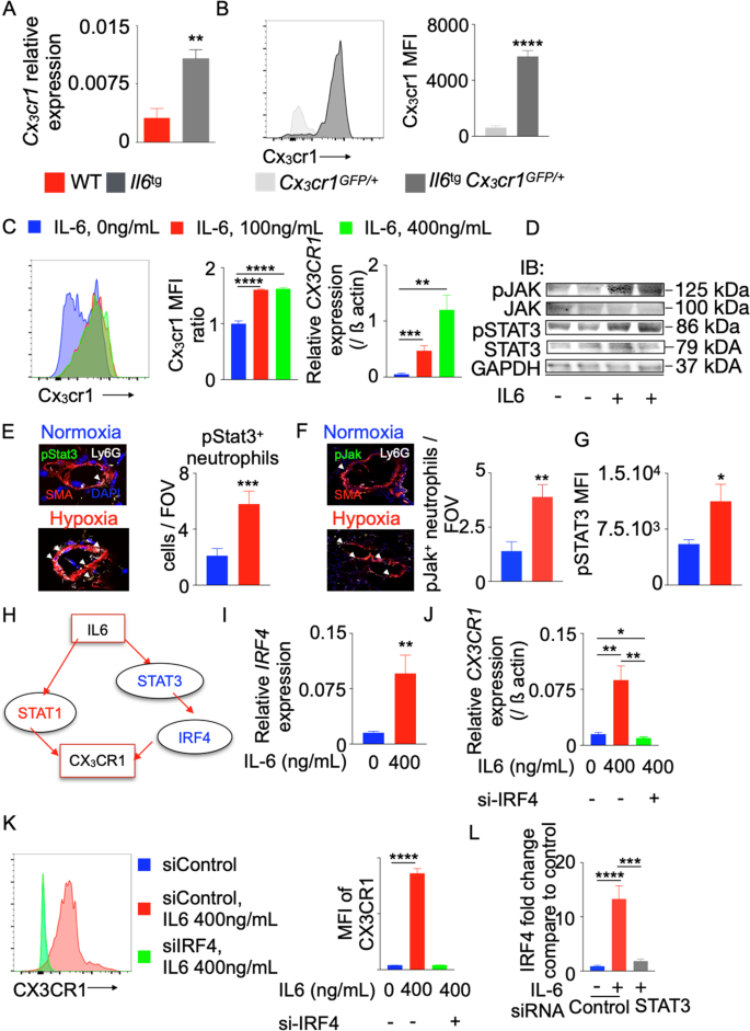 il-6 glutathione neutrophil Interleukin-6 mediates neutrophil mobilization from bone marrow in  pulmonary hypertension