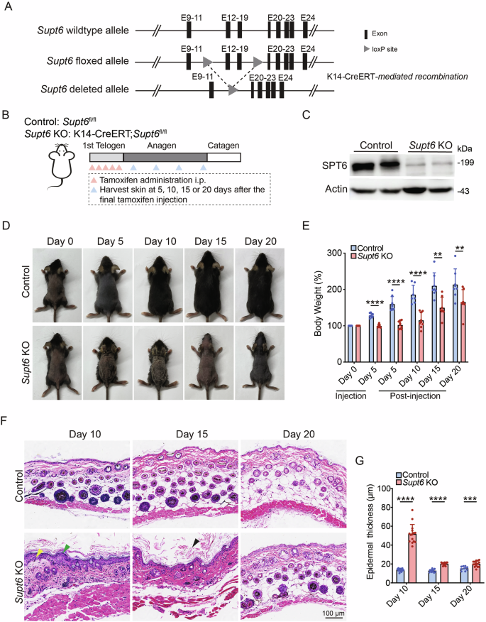Fig. 1: Epidermal deletion of SPT6 delays the hair cycle and induces hyperplasia and hyperkeratosis in the epidermis.
