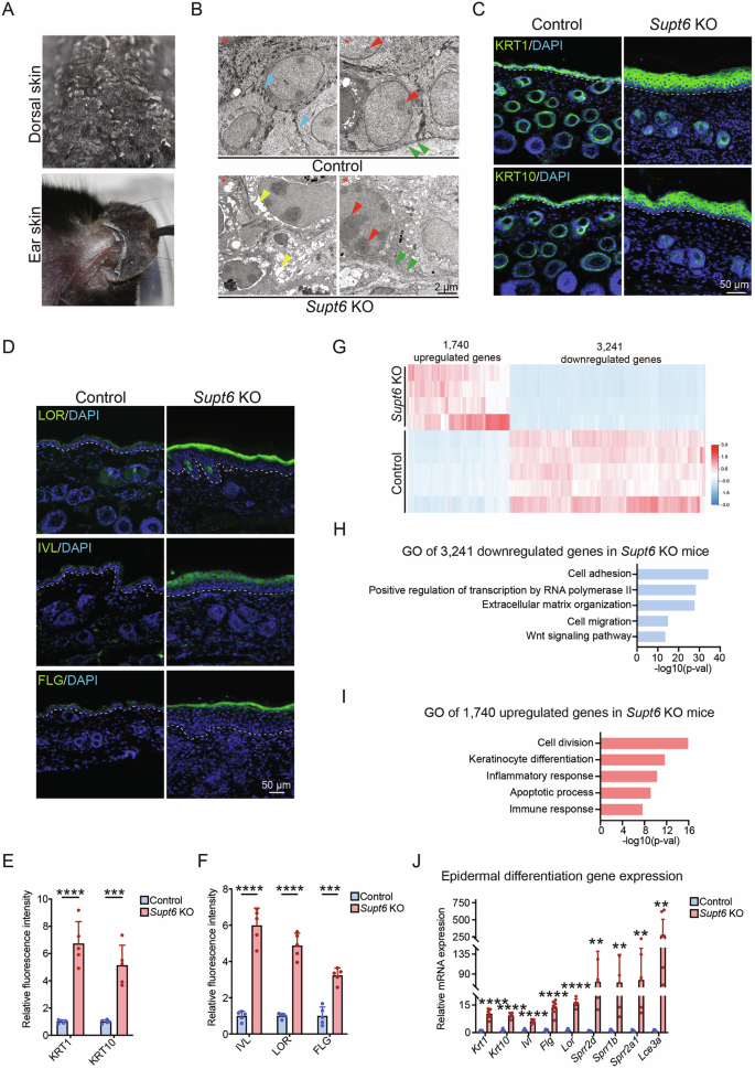 Fig. 2: Supt6 knockout enhances epidermal differentiation.