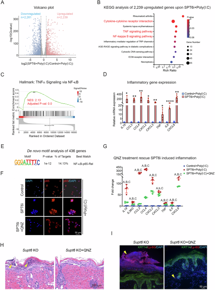 Fig. 7: SPT6 suppresses inflammation via NF-κB signaling in proliferating human keratinocytes.