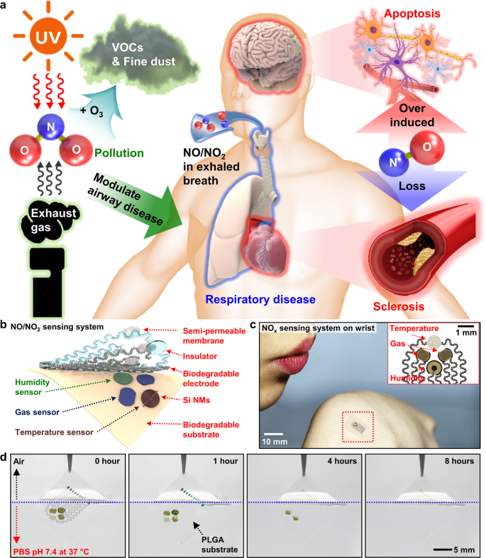 Biodegradable Flexible Silicon Nanomembrane Based No X Gas Sensor System With Record High Performance For Transient Environmental Monitors And Medical Implants Npg Asia Materials Biodegradable Flexible Silicon Nanomembrane Based No X Gas Sensor System With Record High Performance For Transient Environmental Monitors And Medical Implants Npg Asia Materials