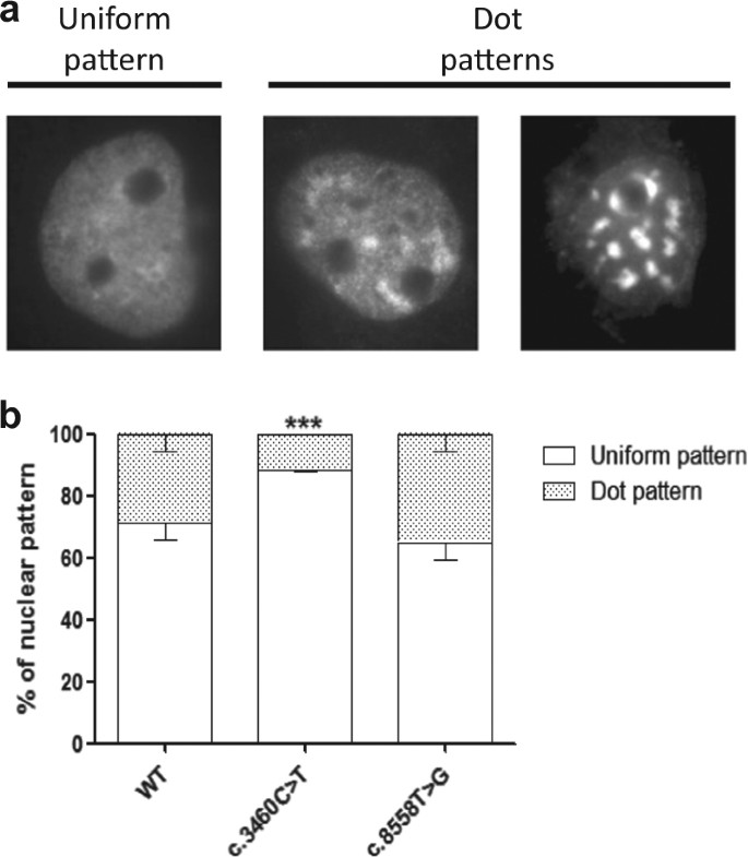 Expanding the phenotype associated to KMT2A variants: overlapping clinical  signs between Wiedemann–Steiner and Rubinstein–Taybi syndromes