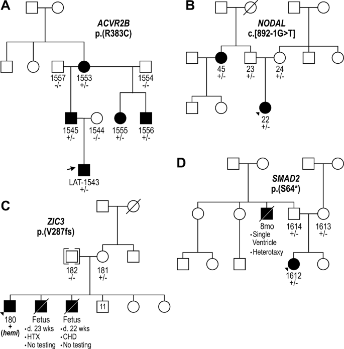 Genetic Architecture Of Laterality Defects Revealed By Whole Exome Sequencing European Journal Of Human Genetics