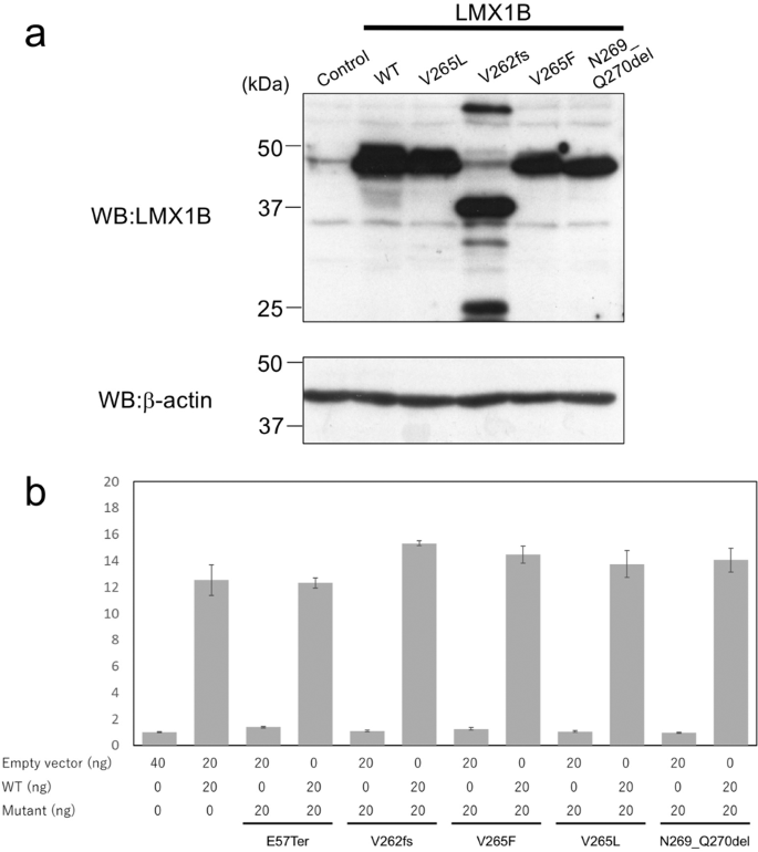 Clinical and genetic characterization of nephropathy in patients with nail-patella syndrome | European Journal of Human Genetics Clinical and genetic characterization of nephropathy in patients with nail-patella syndrome | European Journal of Human Genetics