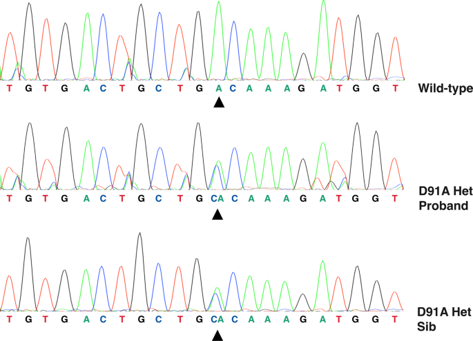 What Do Viking Genetics Have to Do With ALS?