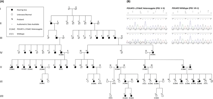 Fig. 1: Pedigree of a North American kindred, initially recruited as two independent families (probands PID V-1, VI-21) showing co-segregation of a novel pathogenic POU4F3 (c.37del) variant and autosomal dominant sensorineural hearing loss.