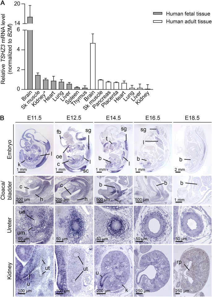 Fig. 4: TSHZ3 expression in human and murine tissues.